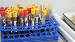 Современный хроматограф закупили для ставропольского краевого наркодиспансера