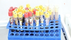 Около 400 ставропольцев вылечились от COVID-19 за неделю