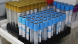 За неделю на Ставрополье 95 человек выздоровели от коронавируса